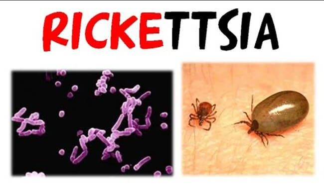 Bệnh Rickettsia do vi khuẩn gây ra nhiều tình trạng suy giảm sức khỏe