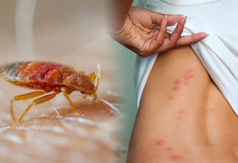 Chống mối để bảo vệ sức khỏe gia đình