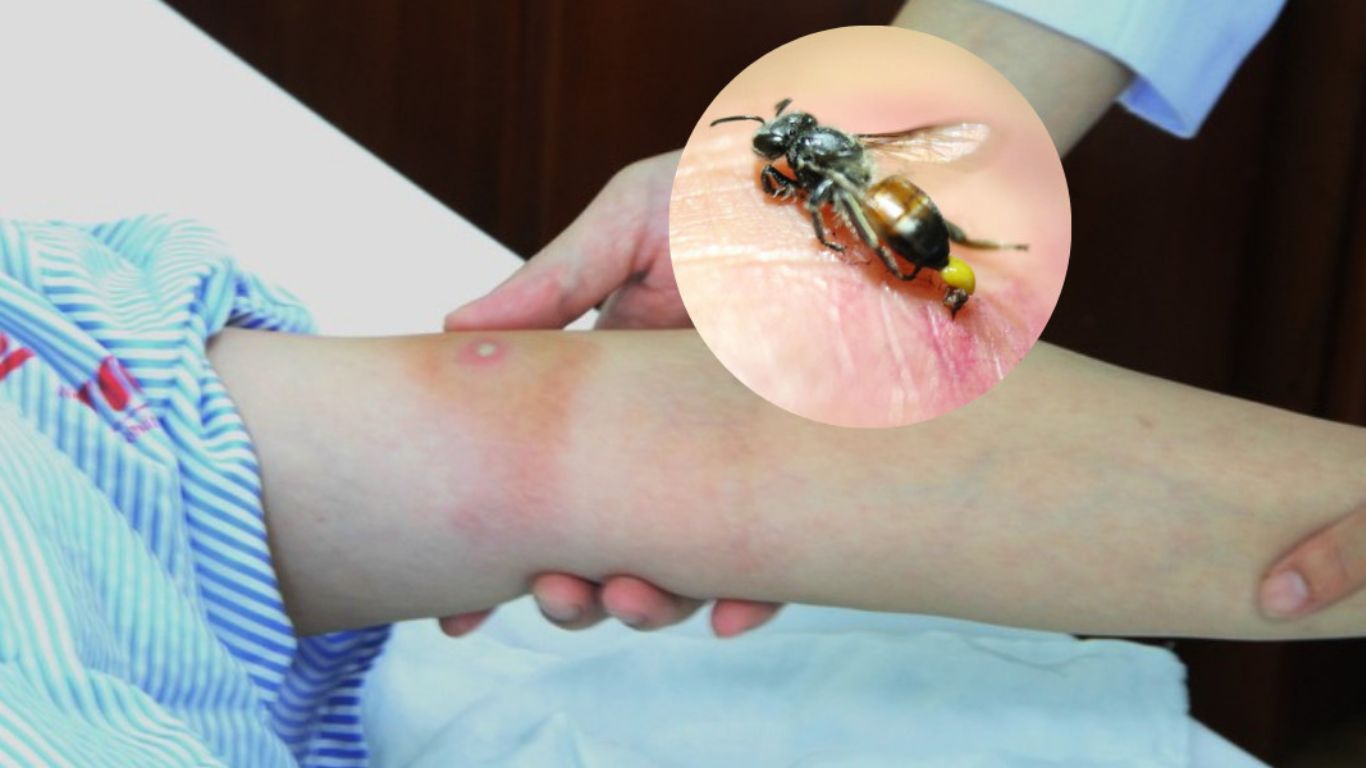 Cách phòng tránh bản thân khỏi ong đốt
