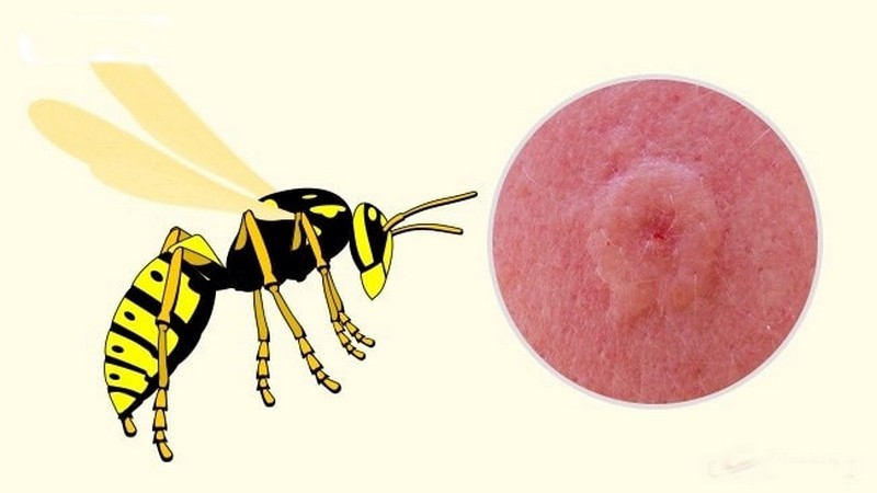 Đặc điểm vết đốt của ong tò vò