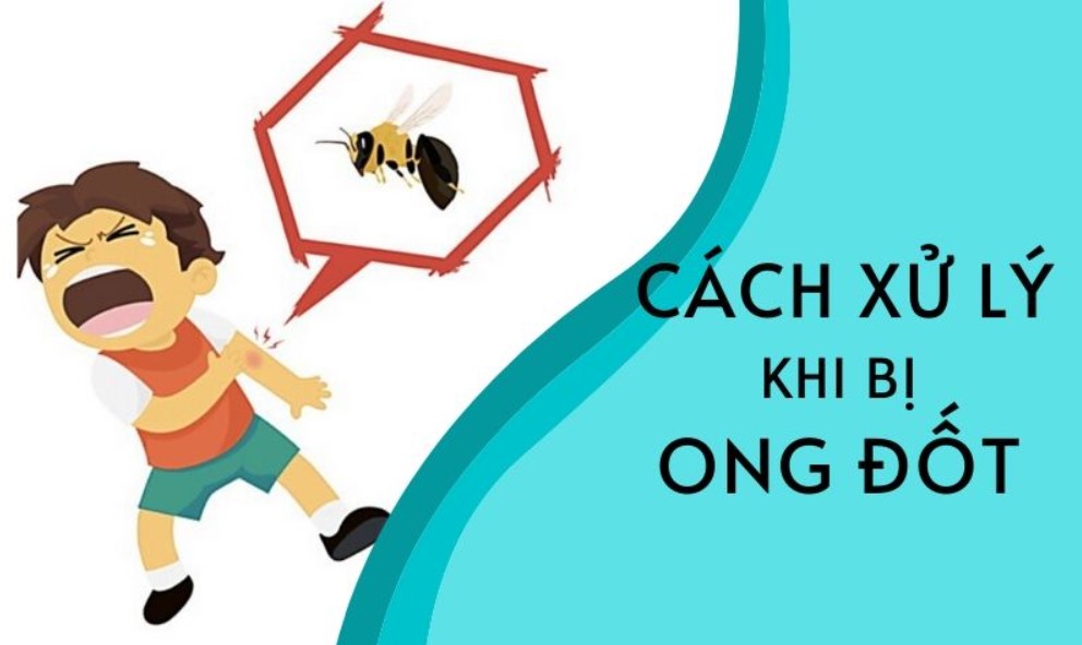 Cách xử lý khi bị ong đất đốt
