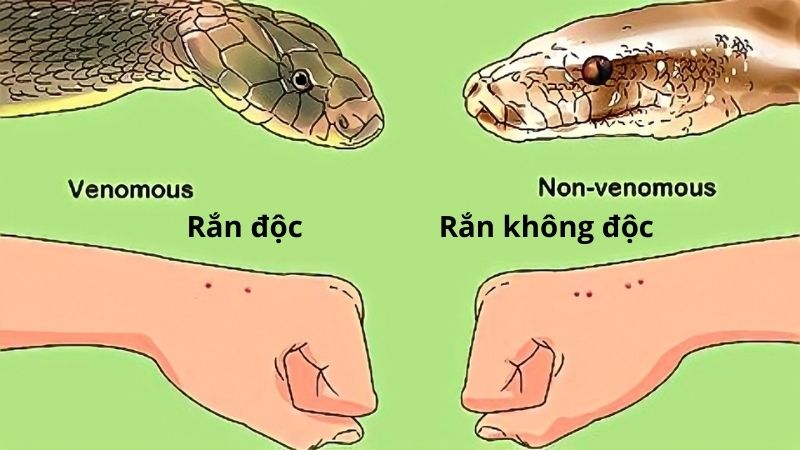 Nhận biết vết cắn của rắn độc và rắn không độc
