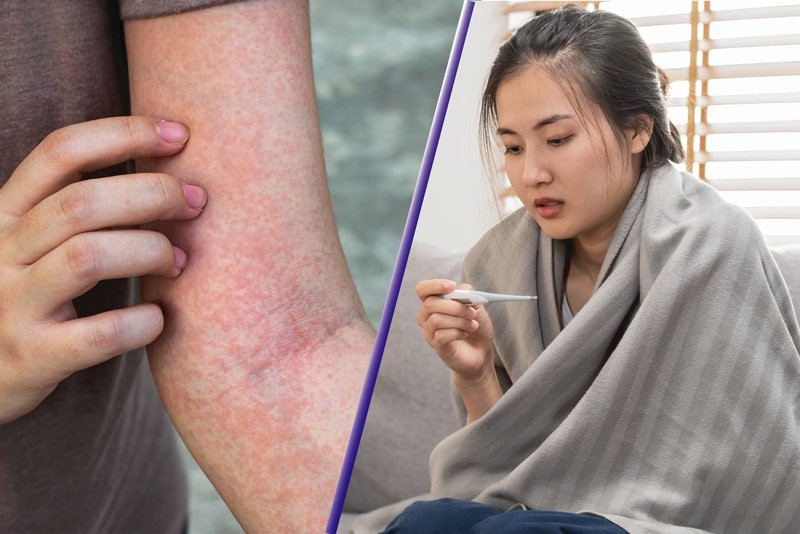 Diễn biến bệnh - Cơn sốt nào nguy hiểm hơn?