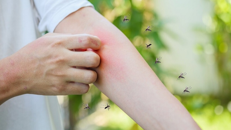 Hướng dẫn chăm sóc và điều trị khi nghi ngờ mắc bệnh