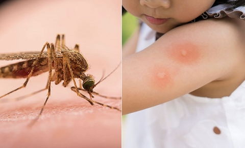 Cơ chế hoạt động và phản ứng của cơ thể khi bị muỗi đốt
