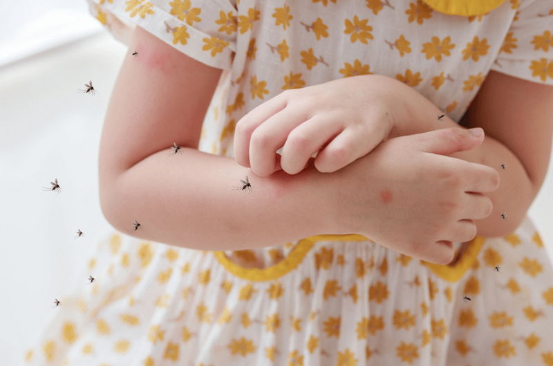 Khi da em bé bị muỗi đốt sẽ gây ngứa dữ dội