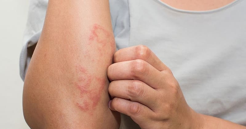 Kiến cánh có hại không? Có cắn người không?