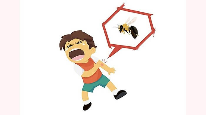 Nhận biết triệu chứng từ nhẹ đến nặng khi bị ong vò vẽ đốt